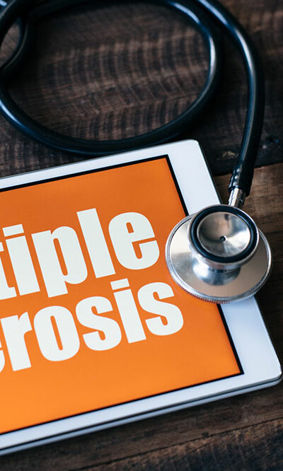 Here are some important things to keep in mind about multiple sclerosis