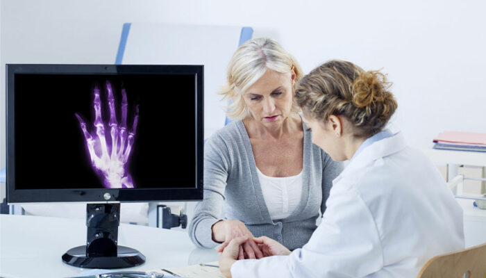 Arthritis – Types and early warning signs